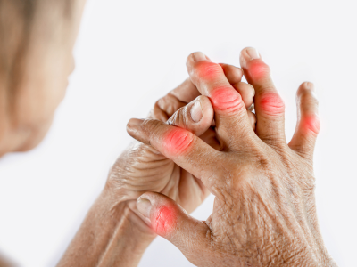 Rheumatology treatments in Pune