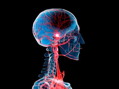 Neurology treatments in Pune